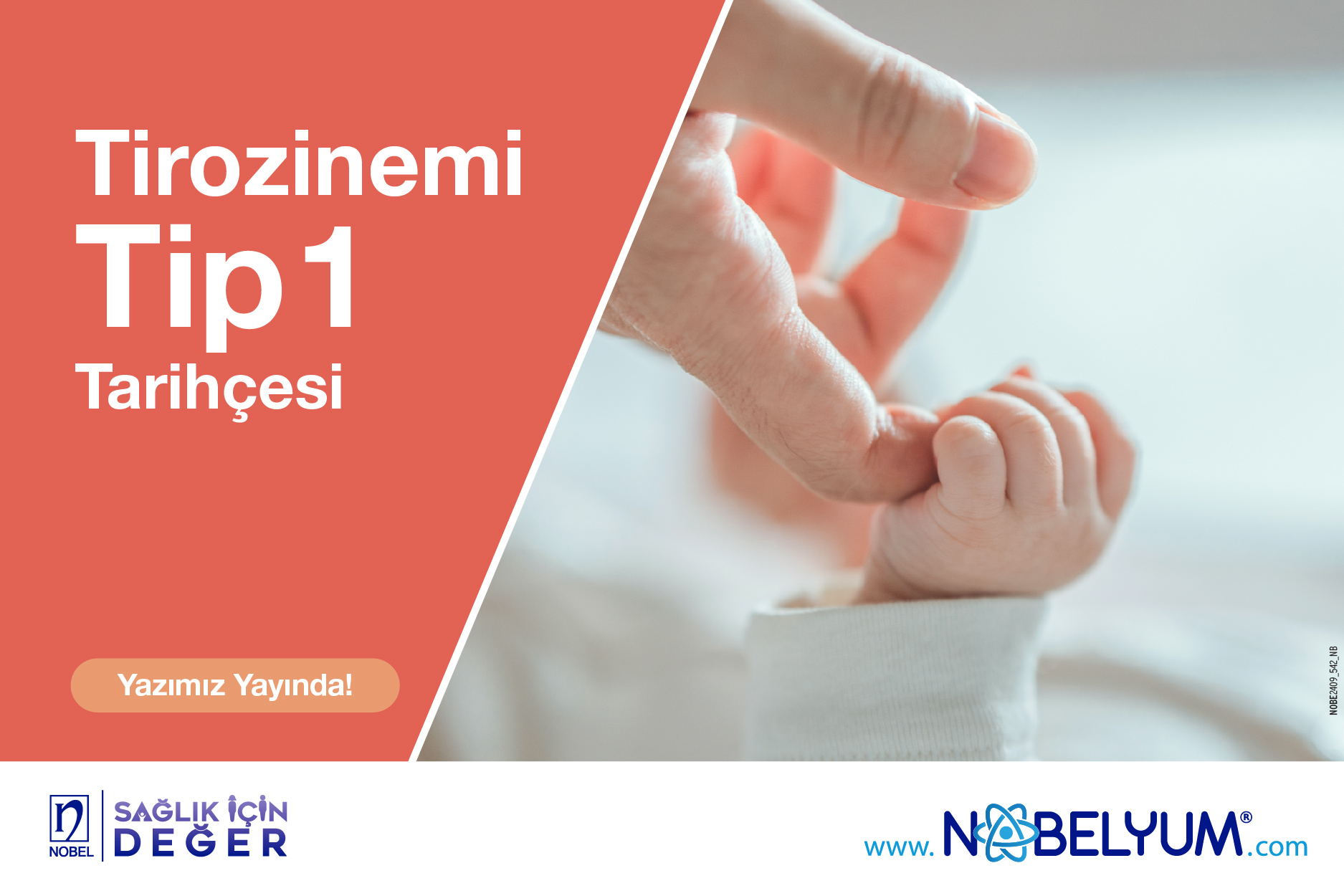 tirozinemi-26112024-guncelgelismeler
