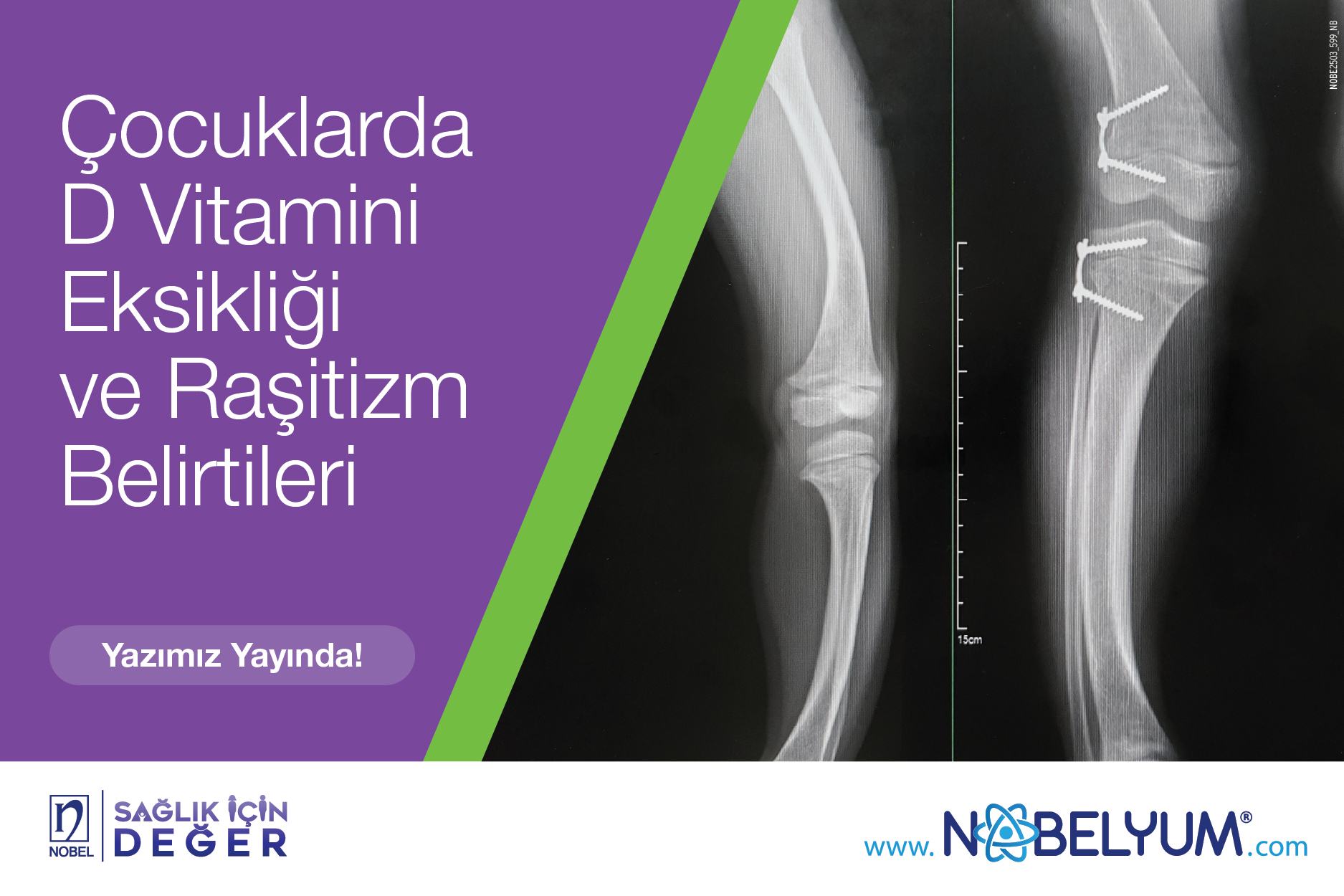 cocuklardadvitamini-24042025-guncelgelismeler