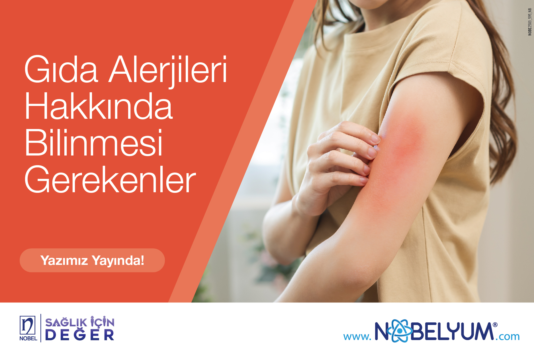 gidaalerjileri-11042025-guncelgelismeler