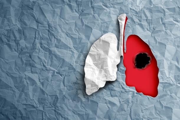 Sigaranın Vücudumuza Korkunç Etkileri