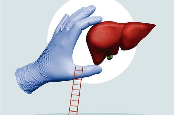 karaciger-220523-thumbnail