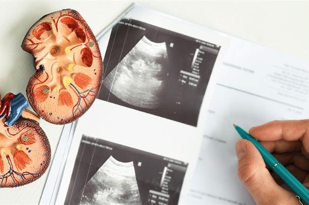 kbh-hiperfosfatemi-160523-2