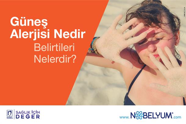 gunesalerjisi-guncel-08072024