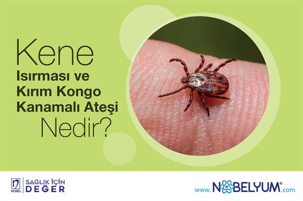 Kene Isırması ve Kırım Kongo Kanamalı Ateşi Nedir?