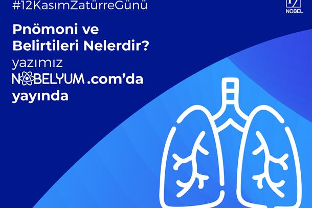 zaturregunu-12112024-guncelgelismeler